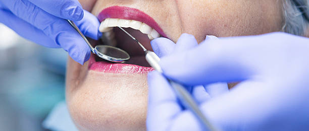 Teeth Whitening in WA