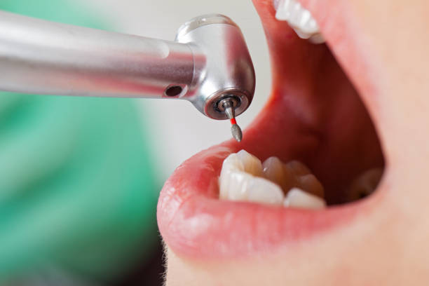 Best Emergency Pediatric Dentist  in Fobes Hill, WA